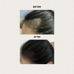 Hair 5